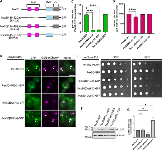 DysF domain is required for recruitment of Pex30 at ER-LD contact sites. (A) Schematic of Pex30 truncations tagged with GFP. (B) WF images of sei1pex30Δ cells endogenously expressing Opi1-mCherry and truncations of Pex30 tagged with GFP on a plasmid grown to logarithmic phase. White arrowheads denote Pex30-GFP and Opi1-mCherry puncta that colocalize. Bar = 4 μm. (C and D) Quantification of cells shown in B showing percent cells with Pex30-GFP and Opi1-mCherry accumulation in the indicated strains. Bars show mean from three independent experiments and SEM. 100 cells per genotype from each replicate were analyzed and compared using one-way ANOVA and Dunnett’s multiple comparison test (****P < 0.0001). (E) 10-fold serial dilutions of sei1pex30Δ cells expressing Pex30-GFP truncation plasmids indicated in A were spotted on synthetic media without leucine. Cells were incubated for 2 days at 30°C and 37°C. (F) Western blot analysis of cell lysates from sei1pex30Δ cells expressing Pex30-GFP truncation plasmids indicated in A. Anti-GFP monoclonal antibody was used to detect Pex30 protein levels, and anti-Porin1 monoclonal antibody was used to detect porin levels as a control. (G) Quantification of protein levels from F. Bars show the mean from three replicates and SEM. One-way ANOVA and Dunnett’s multiple comparison test were used to compare protein levels (*P < 0.05). Source data are available for this figure: SourceData F3. WF, widefield images.