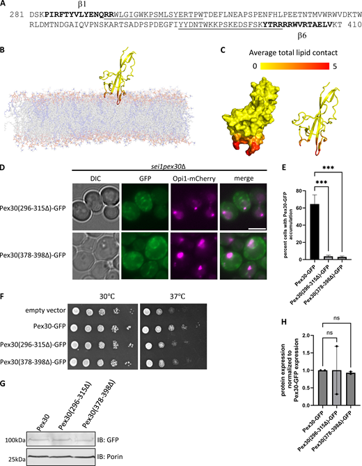 All-atom MD simulations to characterize DysF domain and its membrane interactions. (A) Amino acid sequence of the DysF domain, with residues involved in membrane anchoring underlined, and β1 and β6 strands depicted by bolded text. (B) Snapshot from a simulation of the DysF domain with a 70:30 DOPC:DOPA bilayer. The tails of DOPC and DOPA are shown in grey and blue, respectively. (C) Surface and cartoon representation of the DysF domain. Each residue is colored based on its average number of lipid contacts, with a contact defined as a lipid within 4.5 Å of the residue. (D) WF images of sei1pex30Δ cells endogenously expressing Opi1-mCherry and GFP-tagged Pex30 (296–315Δ) or Pex30 (378–398Δ) plasmids grown to logarithmic phase. Bar = 4 μm. (E) Quantification of cells shown in D showing percent cells with Pex30-GFP accumulation in the indicated strains. Bars show mean from three independent experiments and SEM. 100 cells per genotype from each replicate were analyzed and compared using one-way ANOVA and Dunnett’s multiple comparison test (***P < 0.001). (F) 10-fold serial dilutions of sei1pex30Δ cells expressing Pex30-GFP truncation plasmids were spotted on synthetic media without leucine. Cells were incubated for 2 days at 30°C and 37°C. (G) Western blot analysis of cell lysates from sei1pex30Δ cells expressing Pex30-GFP and DysF truncation plasmids in D. Anti-GFP monoclonal antibody was used to detect Pex30 protein levels, and anti-Porin1 monoclonal antibody was used to detect porin levels as a control. (H) Quantification of protein levels from G. Bars show the mean from two replicates and SEM. One-way ANOVA and Dunnett’s multiple comparison test were used to compare protein levels. Source data are available for this figure: SourceData F5. WF, widefield images.