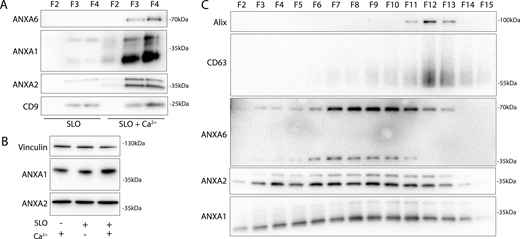 Annexins within EVs are shifted in apparent molecular weight. (A) Immunoblots of gradient fractions show enrichment of indicated EV markers after 200 ng/ml SLO treatment, with or without 1 mM Ca2+ in the media. F2, F3, and F4 refer to buoyant fractions of a sucrose step gradient of the conditioned medium 100k × g pellet fraction. (B) Immunoblot analysis of cell lysates after treatment with indicated combinations of 1 mM Ca2+ and 200 ng/ml SLO is shown. (C) Immunoblots show separation of indicated EV markers after 200 ng/ml SLO treatment. F2–F15 refer to fractions #2–15 of an iodixanol gradient of the conditioned medium 100k × g pellet fraction, moving from low to high density. Source data are available for this figure: SourceData F3.