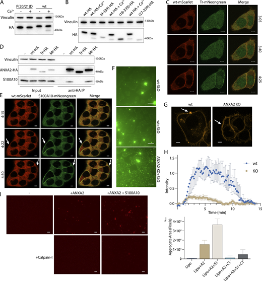 Calpain cleavage attenuates the membrane binding and scabbing activity of annexin A2. (A) Immunoblot analysis of lysates from cells expressing WT ANXA2-HA or ANXA2[P20D, P21D]-HA. Ca2+ (1 mM) was added to lysis buffer where indicated. (B) Immunoblot analysis of lysates from cells expressing WT ANXA2-HA or ANXA2-HA with the indicated N-terminal truncations. Ca2+ (1 mM) was added to lysis buffer where indicated. (C) Representative confocal micrographs of ANXA2-mScarlet (wt-mScarlet) and ANXA2(18–339)-mNeonGreen (Tr-mNeonGreen)–expressing cells. Image times are relative to the addition of 400 ng/ml SLO. Scale bars: 5 μm. (D) Immunoblot analysis of lysates and anti-HA immunoprecipitation elutions from cells expressing WT ANXA2-HA (wt-HA), ANXA2(18-339)-HA (Tr-HA), ANXA2[P20D, P21D]-HA (Mt-HA), or no HA construct. (E) Representative confocal micrographs of ANXA2-mScarlet (wt-mScarlet) and S100A10-mNeonGreen–expressing cells. Image times are relative to the addition of 400 ng/ml SLO. Arrows indicate cells with annexin A2 and S100A10 translocating to the membrane. Scale bars: 5 μm. (F) Representative widefield micrographs of WT or annexin A2 KO cells, with 2.5 μM Sytox Green added for 6 min. SLO (200 ng/ml) was added with Sytox Green in the indicated panels. Scale bars: 100 μm. (G) Representative confocal micrographs of FM1-43–stained (2.5 μM) WT or annexin A2 KO cells, 100 s after laser ablation. White arrows indicate the ablation site. Scale bars: 5 μm. (H) Quantification over time of the repair scab intensity from FM1-43–stained (2.5 μM) WT or annexin A2 KO cells. Error bars indicate six experimental replicates. (I and J) Representative widefield micrographs (I) and aggregate size quantification (J) of Texas Red-labeled 200-nm liposomes mixed with the indicated combinations of 300-nM annexin A2 (A2), annexin A2-S100A10 (A2+S1), or Calpain-1 (C1). Scale bars: 50 μm. Error bars indicate two experimental replicates. Source data are available for this figure: SourceData F5.