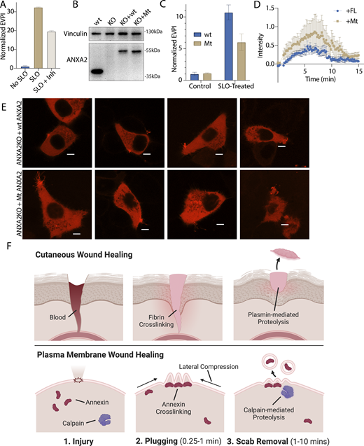 Inhibition of annexin A2 cleavage decreases annexin A2+MV secretion during membrane repair. (A) EV production index from ANXA2-Nluc cells treated with the indicated combinations of 200 ng/ml SLO and 20 μM calpain inhibitor, ALLN. Error bars indicate three experimental replicates. (B) Immunoblot analysis of lysates from WT cells (wt), annexin A2 KO cells, and annexin A2 KO cells expressing WT annexin A2-Nluc (KO + WT) or ANXA2[P20D, P21D]-Nluc (KO + Mt). (C) EV production index from WT ANXA2-Nluc (wt) or ANXA2[P20D, P21D]-Nluc (Mt) cells treated with or without SLO. Error bars indicate three experimental replicates. (D) Quantification over time of the repair scab intensity from FM1-43–stained (2.5 μM) annexin A2 KO cells rescued with ANXA2-mScarlet (wt) or ANXA2[P20D, P21D]-mScarlet (Mt). Error bars indicate six experimental replicates. (E) Confocal micrographs of eight laser-ablated annexin A2 KO cells rescued with either WT ANXA2-mScarlet (wt) or ANXA2[P20D, P21D]-mScarlet (Mt). Images are 2 min, 30 s after ablation. Scale bars: 5 μm. (F) Schematic depicting the current model of plasma membrane repair and annexin+ MV secretion. EPVI, EV production index. Source data are available for this figure: SourceData F6.