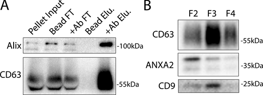 Annexin-containing EVs are distinct from exosomes. (A) Immunoblots show enrichment of exosome proteins from the conditioned medium 100k × g pellet (pellet input) after immunoprecipitation with protein G beads when anti-CD63 antibody (Ab) is added to the binding reaction (FT—binding reaction flow through; Elu—binding reaction elution). (B) Immunoblots show the distribution of EV markers across a sucrose step gradient of the conditioned medium 100k × g pellet fraction. Samples were taken from low density (F2-Fraction #2) to high density (F4-Fraction #4). Source data are available for this figure: SourceData FS1.