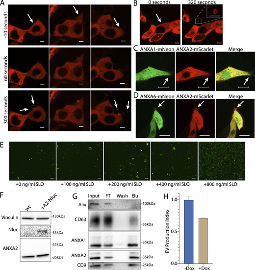 Annexin-containing EVs are shed from the repair scab after plasma membrane damage. (A) Confocal micrographs of ANXA2-mScarlet recruitment in three laser ablation experiments are shown. Image times are relative to the first image taken after ablation. White arrows in the top panes indicate the sites of ablation. Arrows in the bottom panes indicate EVs. Scale bars: 5 μm. (B) Representative confocal micrographs of ANXA2-mScarlet shedding are shown. Image times are relative to the first image taken after ablation. White arrows in panel indicate the site of ablation. Scale bars: 5 μm. (C) Representative confocal micrographs of ANXA2-mScarlet and ANXA1-mNeonGreen–expressing cells after laser ablation. Arrows indicate the ablation site. Scale bars: 10 μm. (D) Representative confocal micrographs of ANXA2-mScarlet and ANXA6-mNeonGreen–expressing cells after laser ablation. Arrows indicate the ablation site. Scale bars: 10 μm. (E) Representative widefield micrographs of cells stained with 1 μM Sytox Green after a treatment period with the indicated SLO concentration and recovery period. Scale bars: 150 μm. (F) Immunoblots show expression of annexin A2-Nluc (A2-Nluc) using a low expression promoter. (G) Immunoblots show enrichment of EV markers after capture with immobilized annexin A5 from the conditioned medium 100k × g pellet fraction (FT—flow through; Elu—elution). (H) EV production index from ANXA2-Nluc cells expressing mCherry-VPS4a (dominant mutant) under control of a doxycycline-inducible promoter. Cells were pretreated with 200 ng/ml doxycycline (Dox) or DMSO for 6 h, followed by treatment with 200 ng/ml SLO. Error bars indicate three experimental replicates. Source data are available for this figure: SourceData FS2.