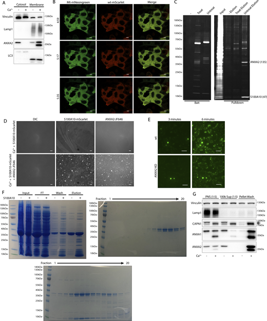 Calpain cleavage attenuates the membrane binding and scabbing activity of annexin A2. (A) Immunoblot analysis of cytosol and membrane fractions, with or without 1 mM Ca2+ added prior to fractionation. (B) Representative confocal micrographs of ANXA2-mScarlet (wt-mScarlet) and ANXA2[P20D, P21D]-mNeonGreen (Mt-mScarlet)–expressing cells. Image times are relative to the addition of 400 ng/ml SLO. Scale bars: 5 μm. (C) Total protein (Sypro Ruby staining) analysis of HaloTag “pulldown” on chloroalkane-coated beads is shown, using no bait (−), porcine calpain-1–treated annexin A2-HaloTag bait (treat), or untreated annexin A2-HaloTag bait (untreat). Proteins are labeled with spectral counts, in parentheses, from gel excision-mass spectrometry. (D) Representative widefield micrographs of purified S100A10-mScarlet (1 μM) binding to GUVs with or without annexin A2-HaloTag-JF646 (1 μM). Scale bars: 50 μm. (E) Representative widefield micrographs of WT or annexin A2 KO cells treated with 200 ng/ml SLO and 2.5 μM Sytox Green without Ca2+ in the media. Scale bars: 100 μm. (F) Coomassie-stained gels showing purification of annexin A2 or annexin A2–S100A10 complex from E. coli. Panel I shows the initial purification by eluting annexin A2 from the E. coli lysate pellet fraction in a Ca2+-dependent manner (Input—lysate input; FT—100k × g pellet flow through; Wash—CaCl2-containing 100k × g pellet wash; Elution—10 mM ATP elution from 100k × g pellet fraction). Where indicated lysate from S100A10-expressing E. coli was mixed 1:1 with annexin A2 E. coli lysate before purification. Panels II and III show size exclusion chromatography fractions of annexin A2 and annexin A2–S100A10 complex, respectively. (G) Immunoblot analysis shows mechanically lysed cells sequentially fractionated into PNS (diluted 1:5 before loading), 100k × g centrifuged PNS supernatant (100k Sup, diluted 1:5 before loading), and 100k × g pellet washed with 5 mM EGTA and recentrifuged (Pellet Wash). Samples where 1 mM Ca2+ was initially added to PNS are indicated. Arrows indicate uncleaved and autolyzed CAPN1. Source data are available for this figure: SourceData FS5.